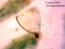 Cyphonautes larve (a bryozoan)